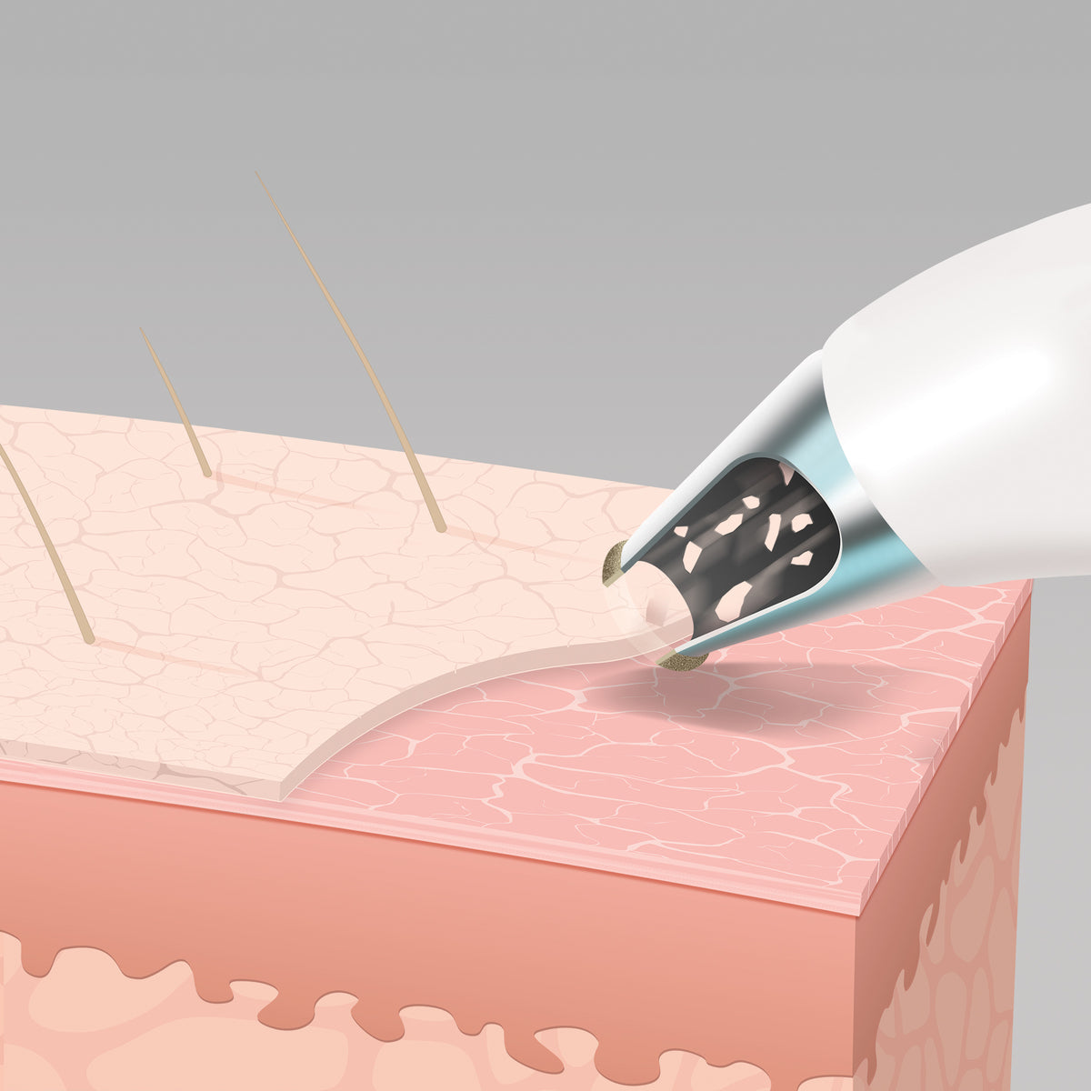 Radiance Microdermabrasion (Exfoliator and Cooling) Device Homedics